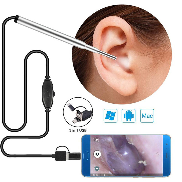 Kev Kho Mob Endoscope Lub Koob Yees Duab Pob ntseg Nasal Endoscope Usb Otoscope